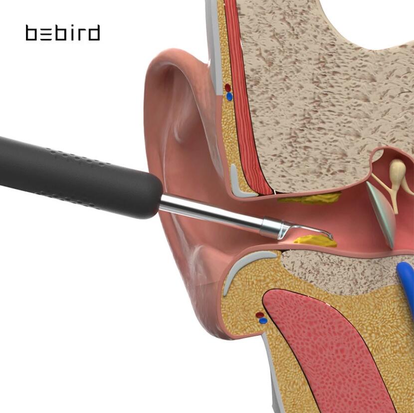 Endoscope Ear Picker Tool eprolo