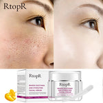 Load image into Gallery viewer, RtopR Anti-Wrinkle Anti Aging Whitening Face Cream